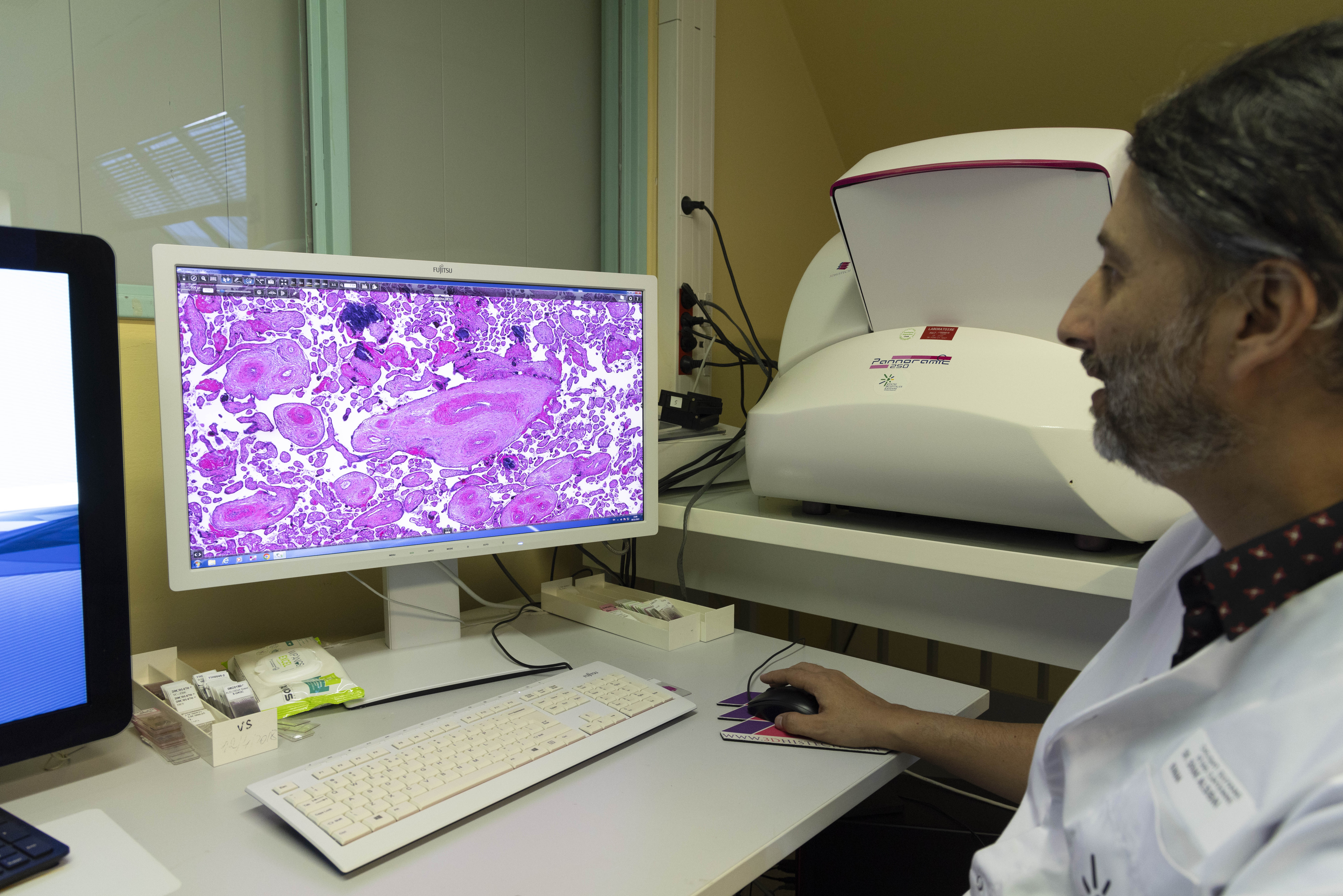 Analyse d'un echantillon de placenta